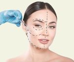 Non-Invasive Facial Fat Removal: Discover Modern Techniques, Practical Suggestions, and Helpful Resources